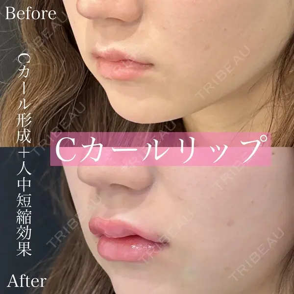 ルラ美容クリニック 渋谷本院 昼間 路子医師の症例