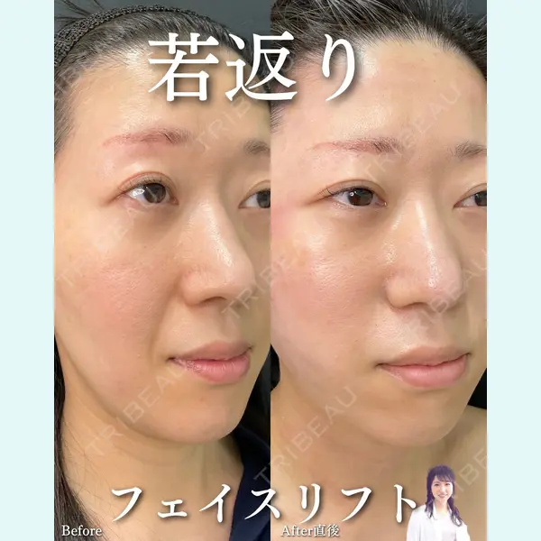 ルラ美容クリニック 渋谷本院 住友 沙織医師の症例