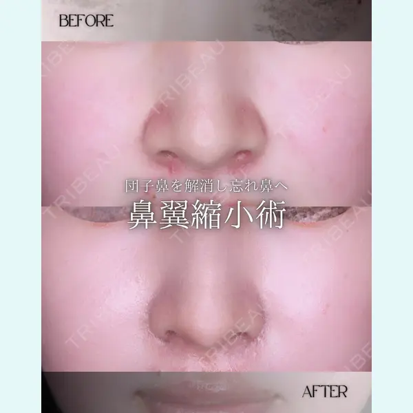 小倉美容外科/美容皮膚科 ビラビューティークリニック 大村 亞蘭医師の症例