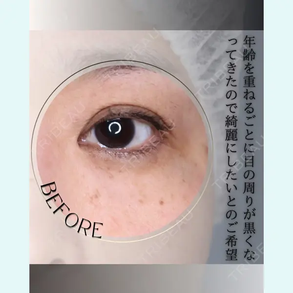 小倉美容外科/美容皮膚科 ビラビューティークリニック 大村 亞蘭医師の症例