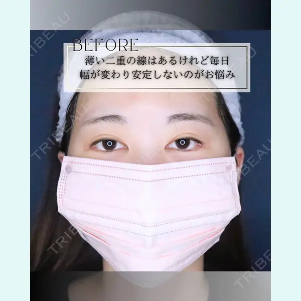 小倉美容外科/美容皮膚科 ビラビューティークリニック 大村 亞蘭医師の症例