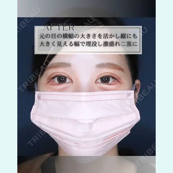 小倉美容外科/美容皮膚科 ビラビューティークリニック 大村 亞蘭医師の症例