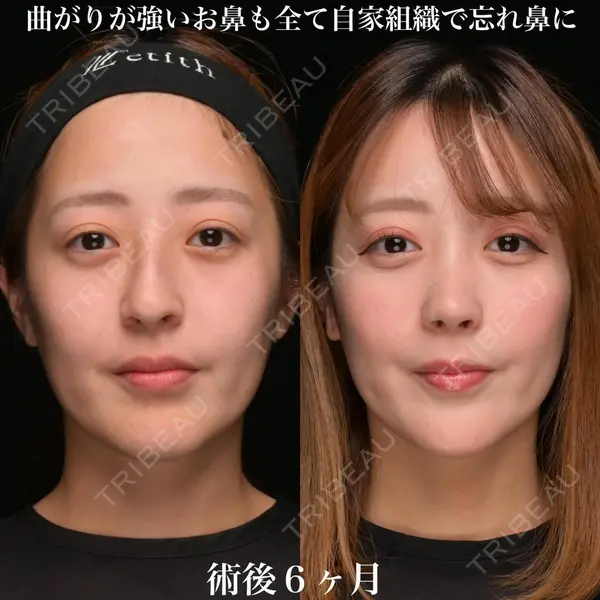Zetith Beauty Clinic 銀座院 鉄 鑠医師の症例
