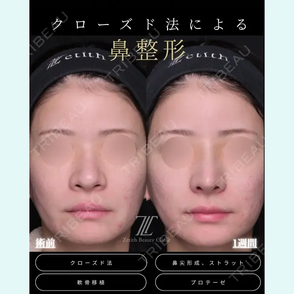 Zetith Beauty Clinic 福岡院 羽根 和秀医師の症例