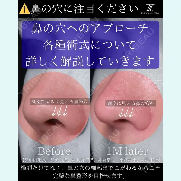 Zetith Beauty Clinic 銀座院 楠本 拓哉医師の症例
