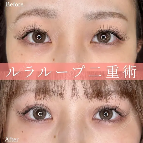 ルラ美容クリニック 名古屋本院の症例