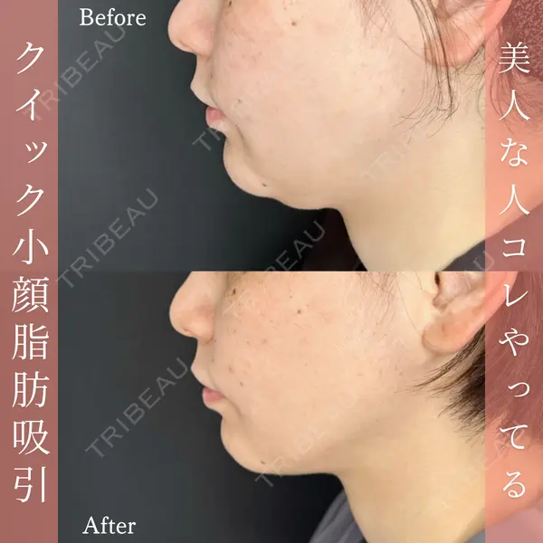 ルラ美容クリニック 名古屋本院 酒井 俊行医師の症例