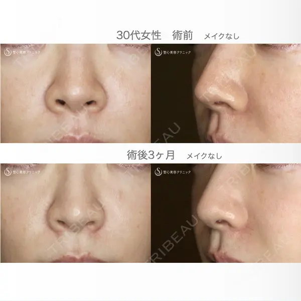 聖心美容クリニック 札幌院 前多 一彦医師の症例