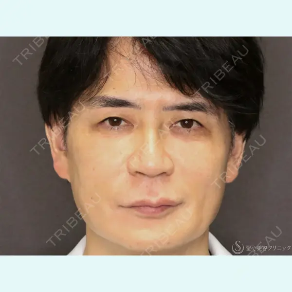 聖心美容クリニック 大阪院 寺町 英明医師の症例