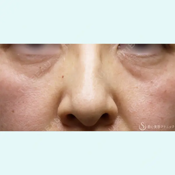 聖心美容クリニック 名古屋院 加藤 大典医師の症例