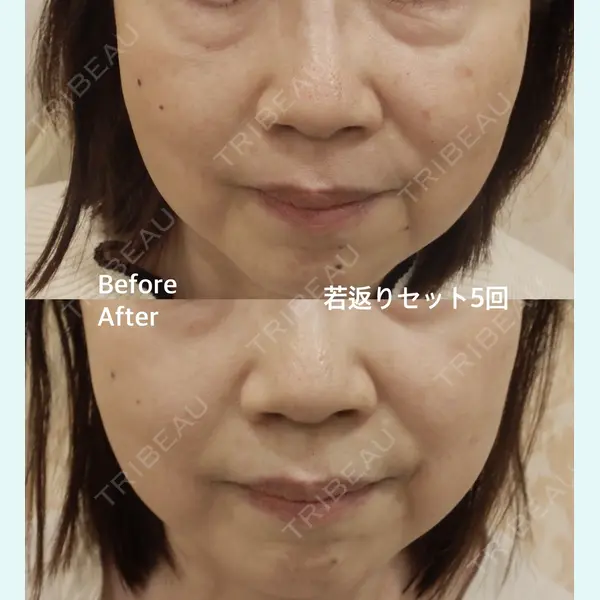 やさしい美容皮膚科・皮フ科　秋葉原院の症例