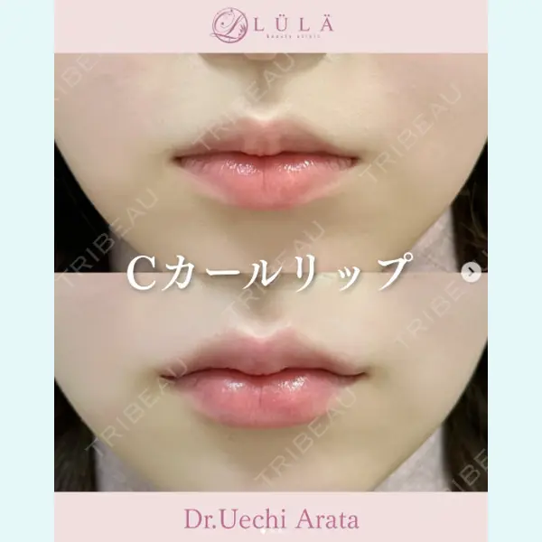 ルラ美容クリニック 上野院の症例