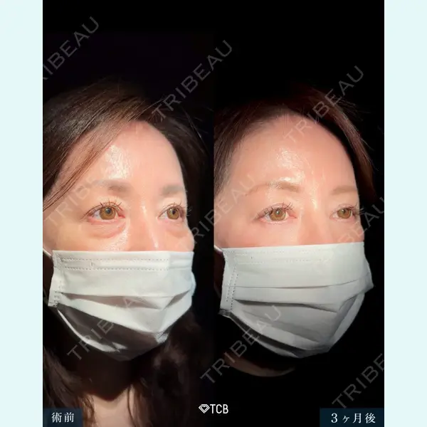 TCB東京中央美容外科 福岡博多院 向田 敦史医師の症例