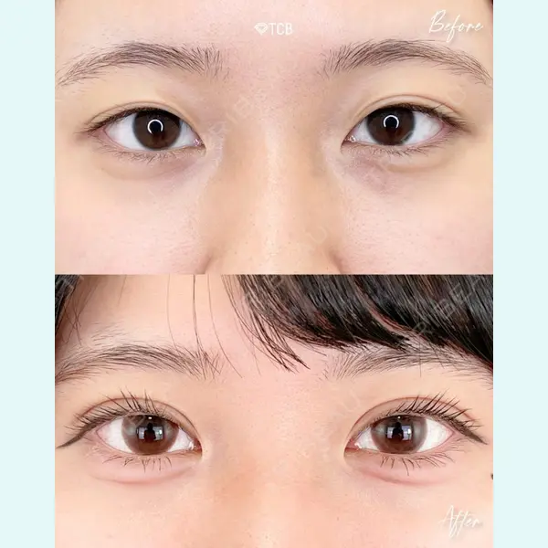 TCB東京中央美容外科 福岡博多院 向田 敦史医師の症例