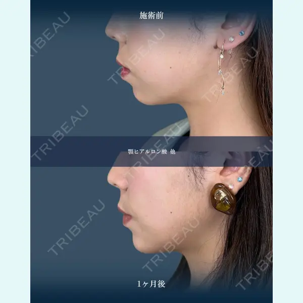 TCB東京中央美容外科 三島院の症例