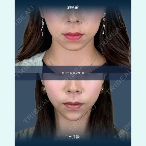 TCB東京中央美容外科 三島院の症例