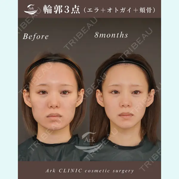 アーククリニック 加藤 雄大医師の症例