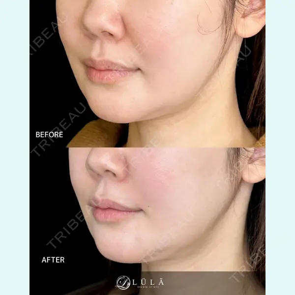 ルラ美容クリニック 大宮院 / ルラスキンクリニック 大宮院 右京 大季医師の症例