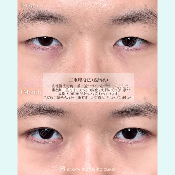 博多もへじのクリニック 村田 将光医師の症例