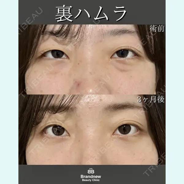 Brandnew Beauty Clinic 平山 容成医師の症例