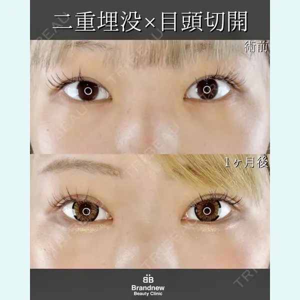 Brandnew Beauty Clinic 平山 容成医師の症例