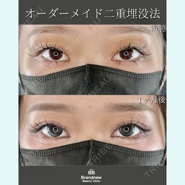 Brandnew Beauty Clinic 平山 容成医師の症例