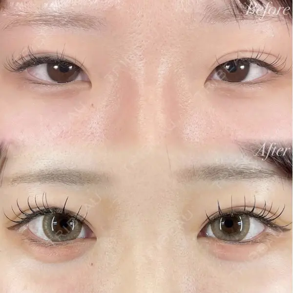 R Beauty CLINIC 銀座院 村山史朗医師の症例