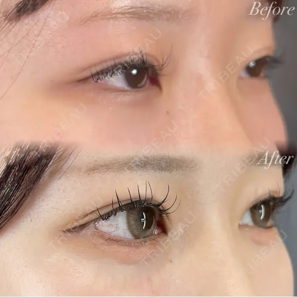 R Beauty CLINIC 銀座院 村山史朗医師の症例