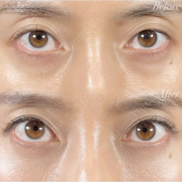 R Beauty CLINIC 銀座院 村山史朗医師の症例