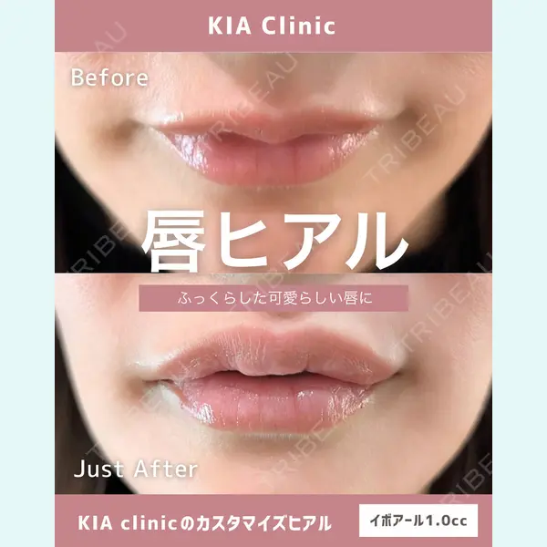 KIA CLINIC 心斎橋院 雲山　盛秀医師の症例