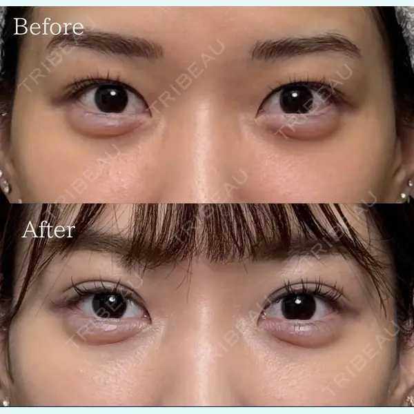 池袋麗歯科・美容皮膚科 夏目 隆太郎医師の症例