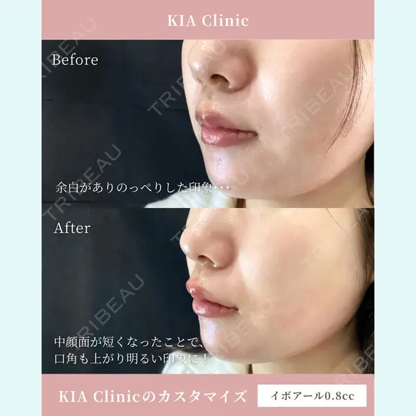 KIA CLINIC 心斎橋院 雲山　盛秀医師の症例