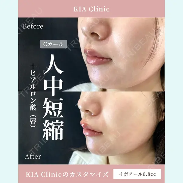 KIA CLINIC 心斎橋院 雲山　盛秀医師の症例