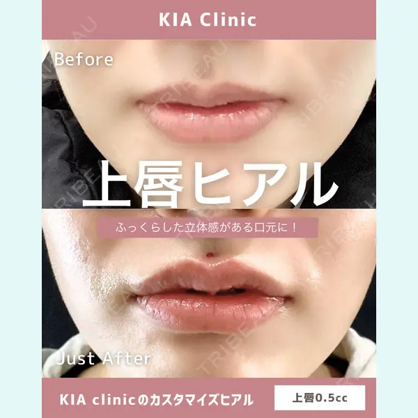 KIA CLINIC 心斎橋院 雲山　盛秀医師の症例