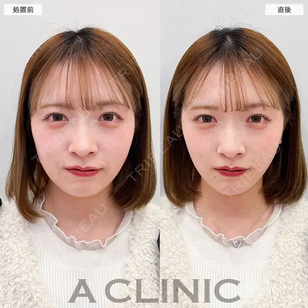 A CLINIC（エークリニック） 福岡院 高平 青洋医師の症例