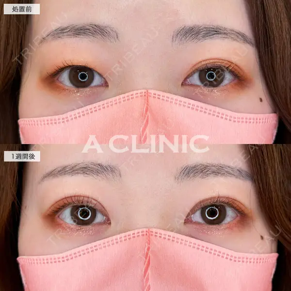 A CLINIC（エークリニック） 仙台院 伊藤 瑠桂医師の症例