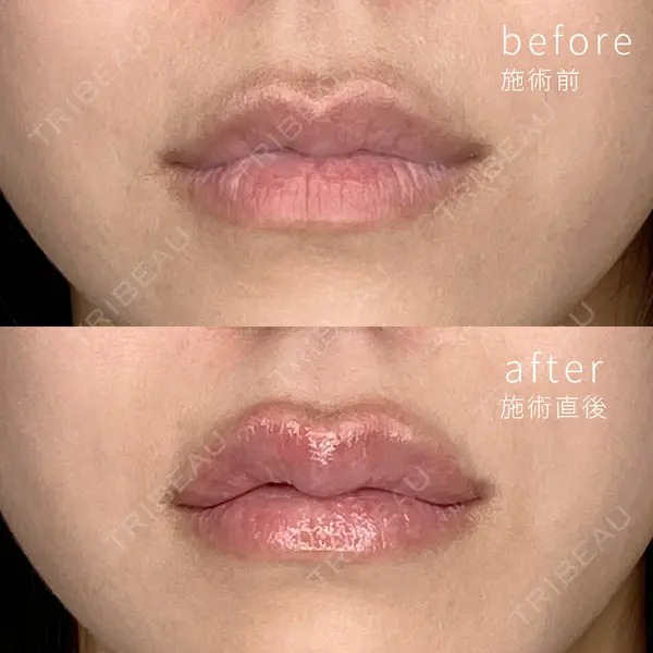 ミニマムスキンクリニック銀座の症例