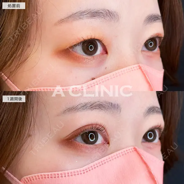 A CLINIC（エークリニック） 仙台院 伊藤 瑠桂医師の症例