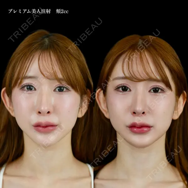 ルラ美容クリニック 池袋院 小海 元医師の症例