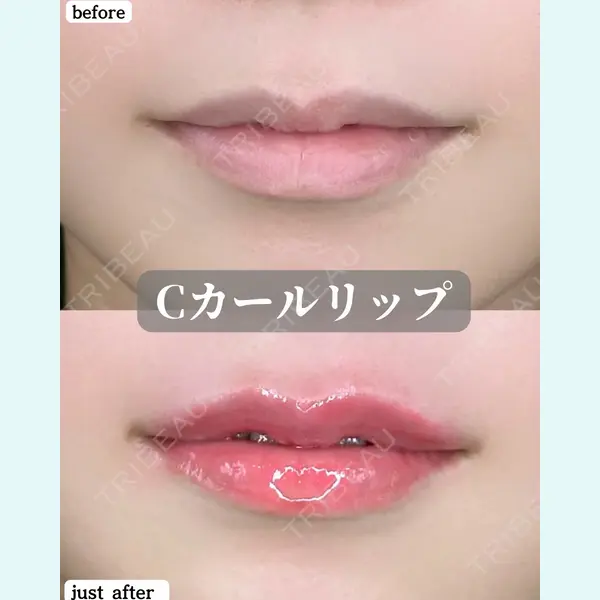 ルラ美容クリニック 福岡本院 樋勝 政博医師の症例