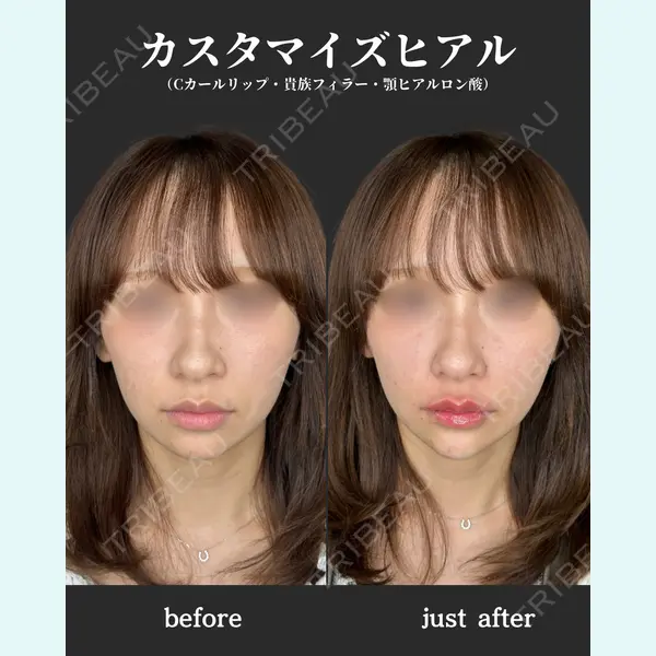 ルラ美容クリニック 福岡本院 樋勝 政博医師の症例