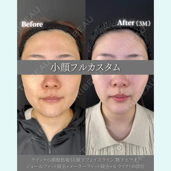 ルラ美容クリニック 大阪本院 平田 一記医師の症例