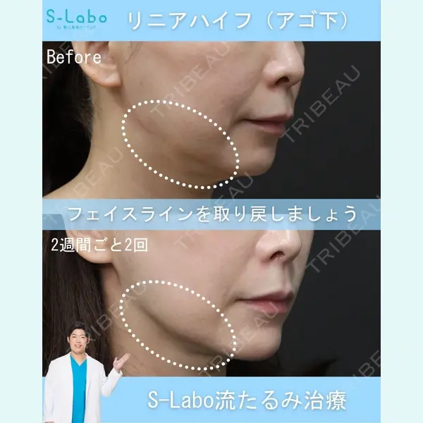 S-Laboクリニック 渋谷院 末岡 大輔医師の症例