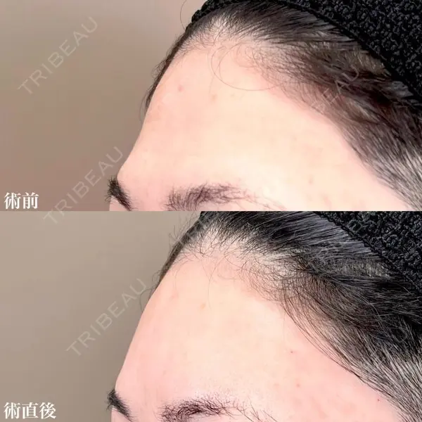 TCB東京中央美容外科 松江院 佐藤 直弥医師の症例