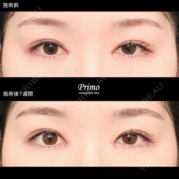 プリモ麻布十番クリニック 大場教弘医師の症例