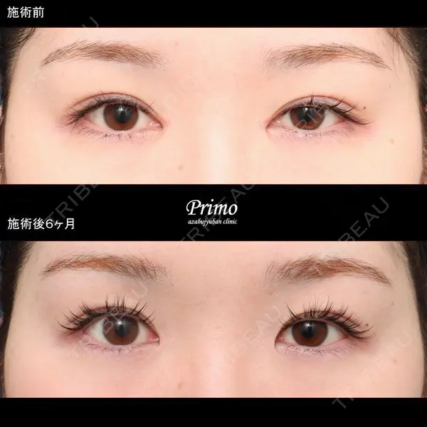 プリモ麻布十番クリニック 大場教弘医師の症例