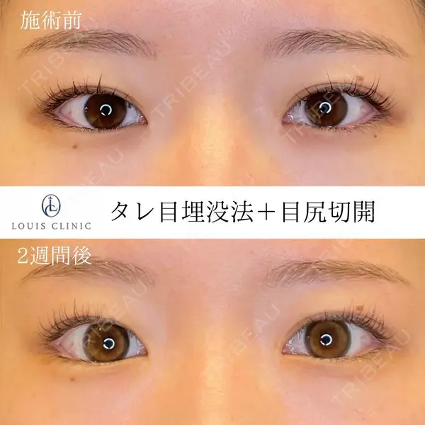 LOUIS CLINIC 二子玉川院【ルイクリニック】 小松 塁医師の症例