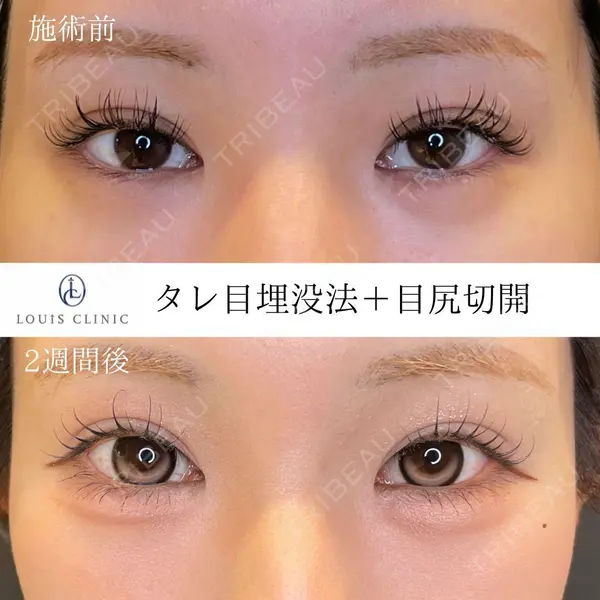 LOUIS CLINIC 二子玉川院【ルイクリニック】 小松 塁医師の症例