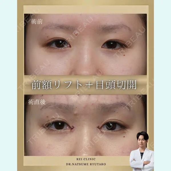 池袋麗歯科・美容皮膚科 夏目 隆太郎医師の症例