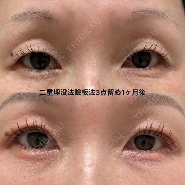 エターナル美容クリニック 久門田 詳医師の症例